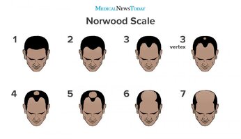the-norwood-scale.jpg