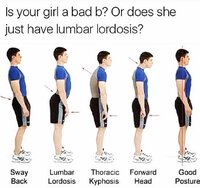 Lumbar lordosis