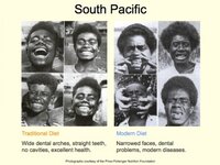 teeth.jpg