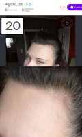 Baldie Baldie