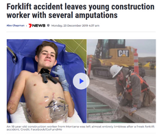 Amputations Amputations