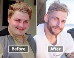 Before after weight loss face transformation 208 5a2e835b949d0  700