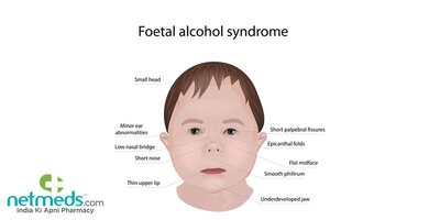 1642664995_Alcohol_big_450.jpg