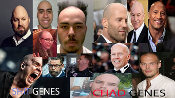 just-shave-it-bro-shit-genes-vs-chad-genes.jpg