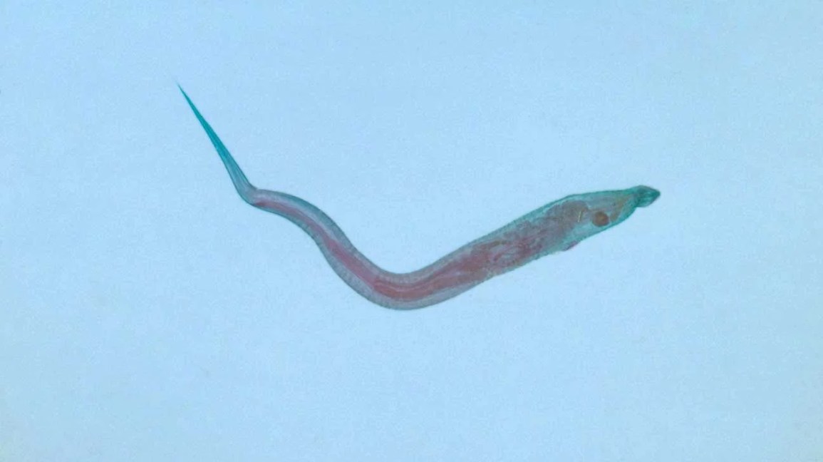 Adult_pinworm-1296x728-slide1.jpg