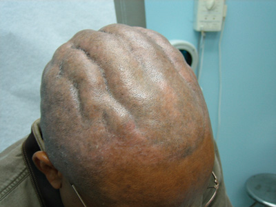 dc0207-case1_52914.jpg