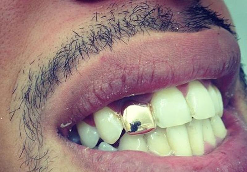 gold-tooth.jpg
