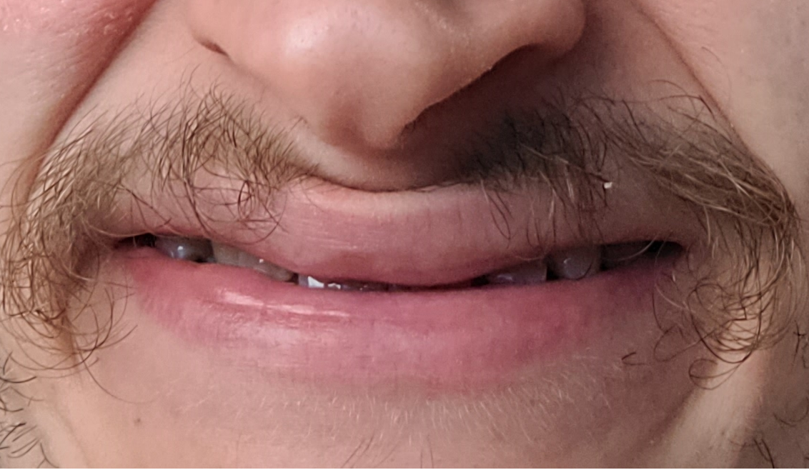 4873585_smile.png