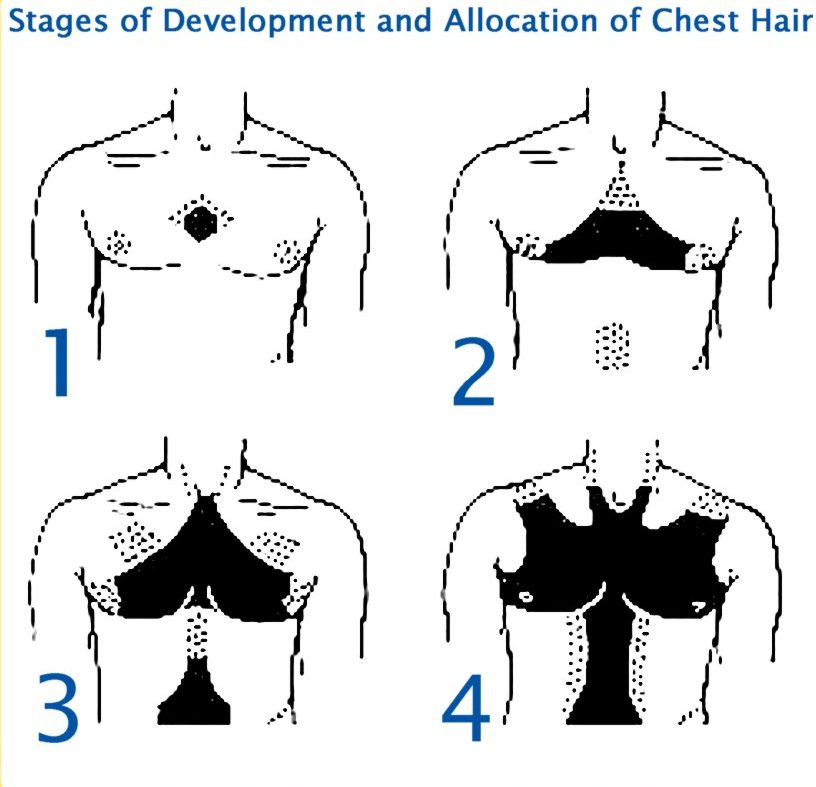 Chest_hair_growth.jpg
