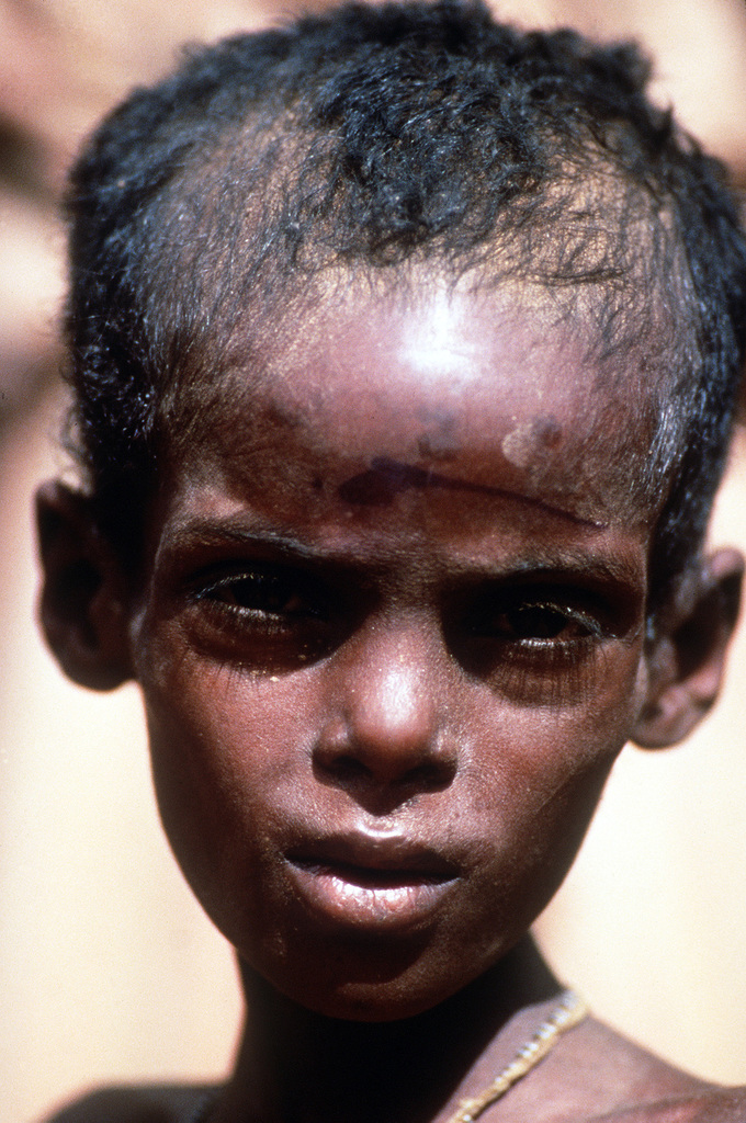 a-portrait-of-a-somalian-boy-one-of-thousands-of-somalians-who-are-receiving-a483c2-1024.jpg