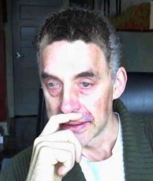 jordan peterson very tired eyes crying