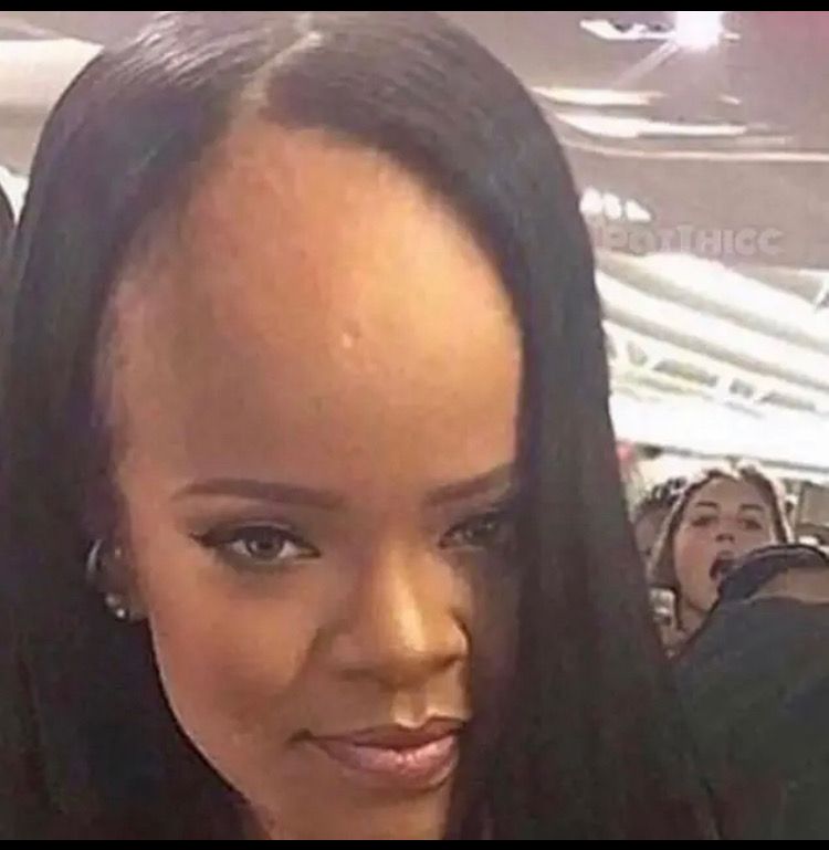 Big forehead memes | Really funny pictures, Haircut memes, Big forehead