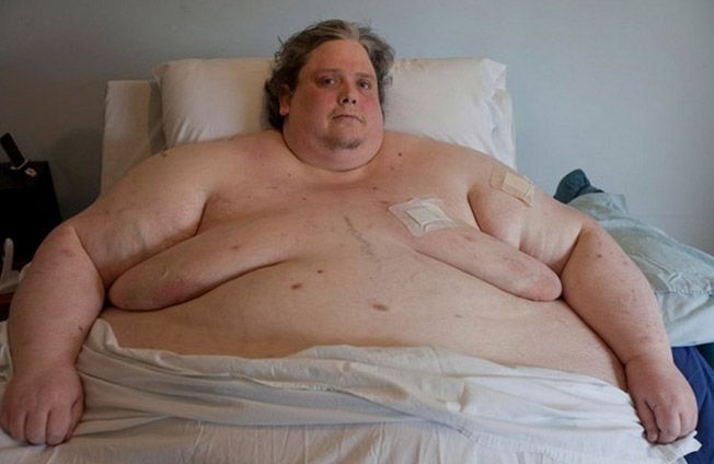 10 Of The Most Obese People To Ever Exist In Human History