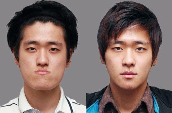 9a97f32db6e4c5b8a4a4235578720134--extreme-plastic-surgery-korean-plastic-surgery.jpg