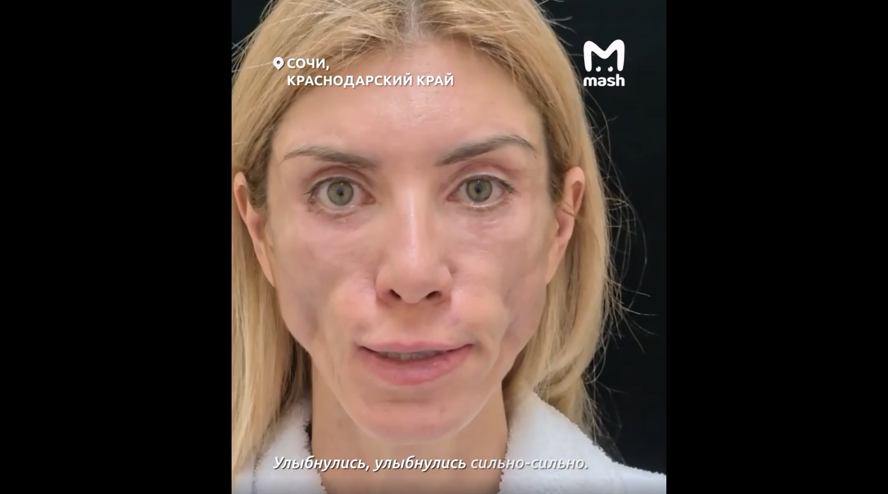 mesh.png