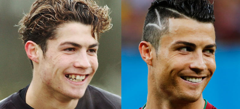 Cristiano-ronaldo-veneers-teeth.jpg