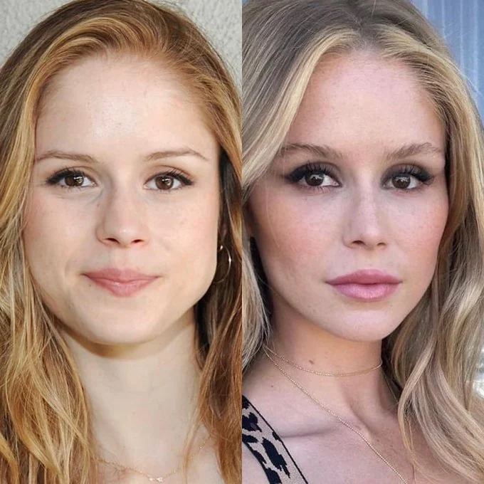 Erin Moriarty Plastic Surgery: Debunking the Rumors