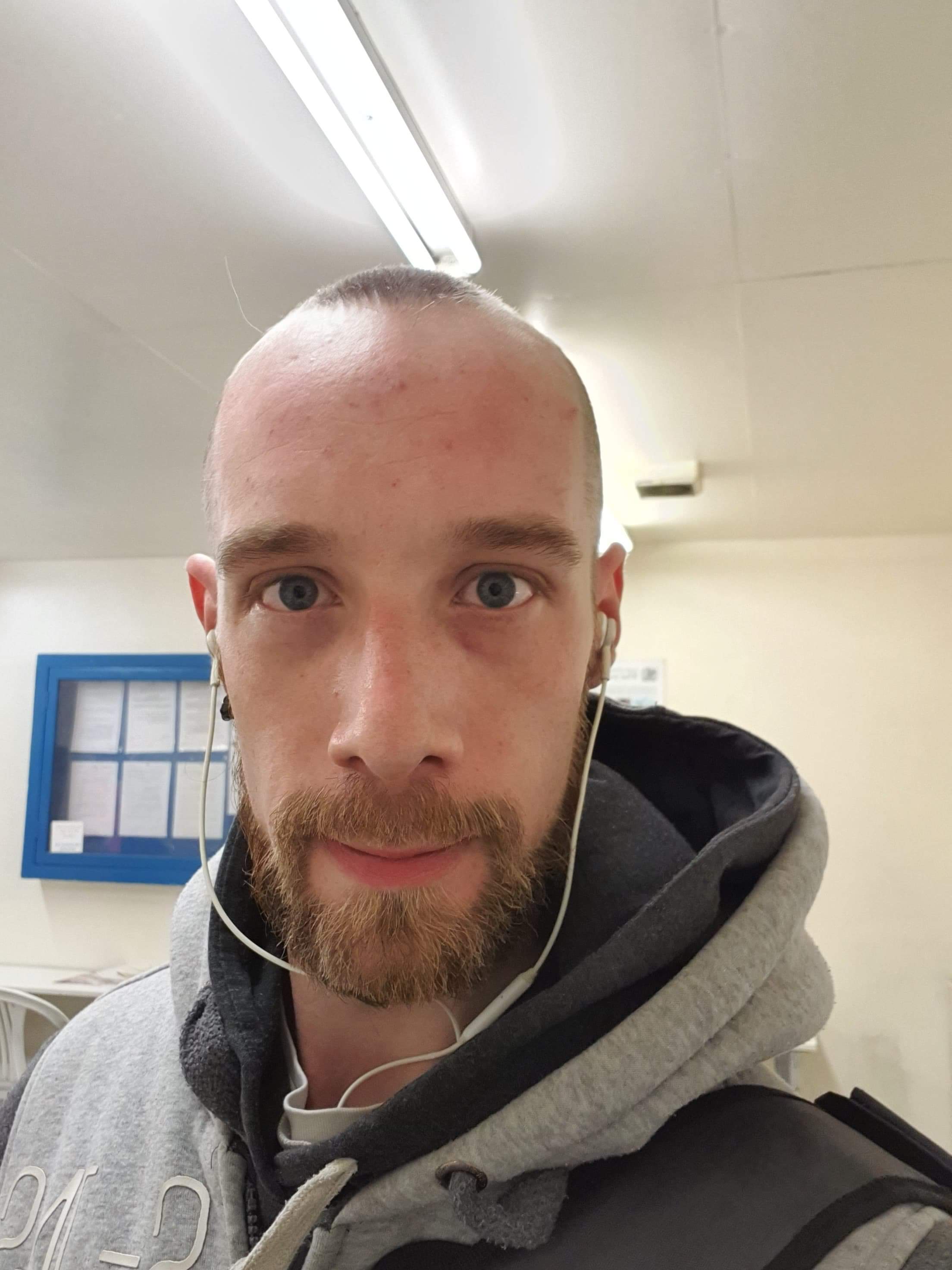 The ugliest guy you'll ever see on Reddit. Hi, it's me. : r/pics