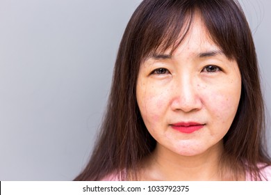 health-care-concept-closeup-face-260nw-1033792375.jpg