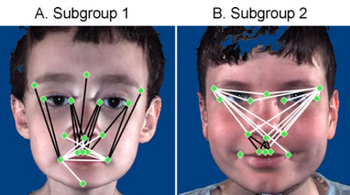 autismface.png