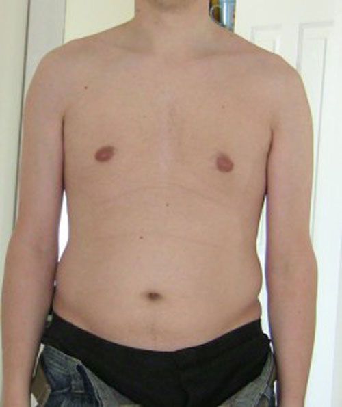 SKINNY-FAT-14.jpg