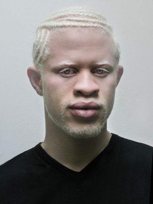 7ae33cba74279d2f9cf8c67b2eefe0ff--albino-african-black-man.jpg