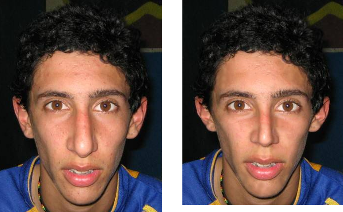 L8O2kdo.png