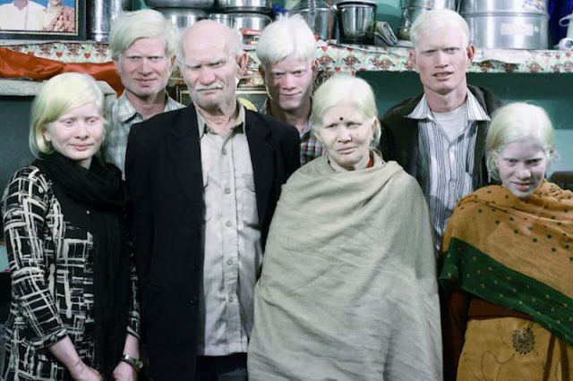 the_largest_albino_family_in_the_world_640_03.jpg