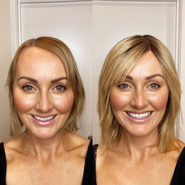 Everything you need to know before deciding on a topper or a wig
