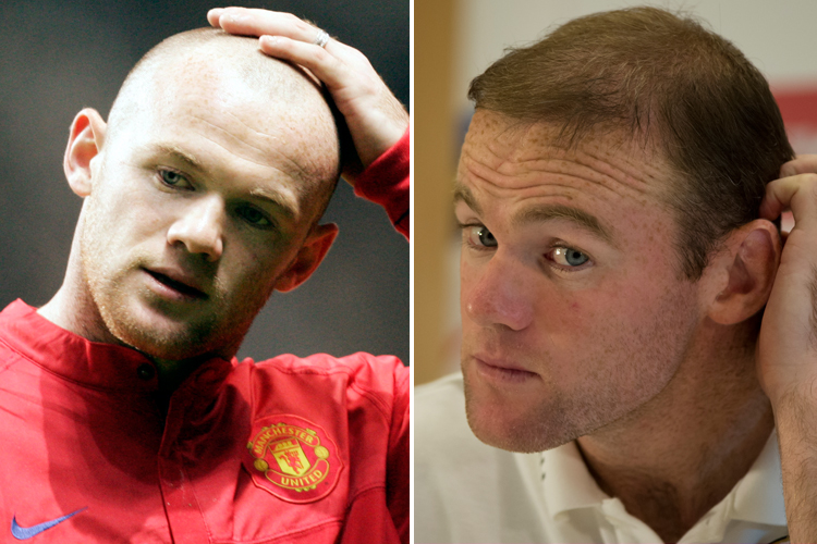 bald-celeb-3-rooney.jpg