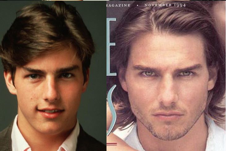 4 Plastic Surgeries Guys Are Getting to Look More Manly according to Men's  Journal | Page 3 | Sherdog Forums | UFC, MMA & Boxing Discussion