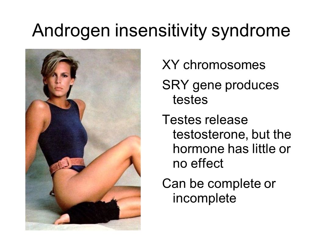 Androgen+insensitivity+syndrome.jpg