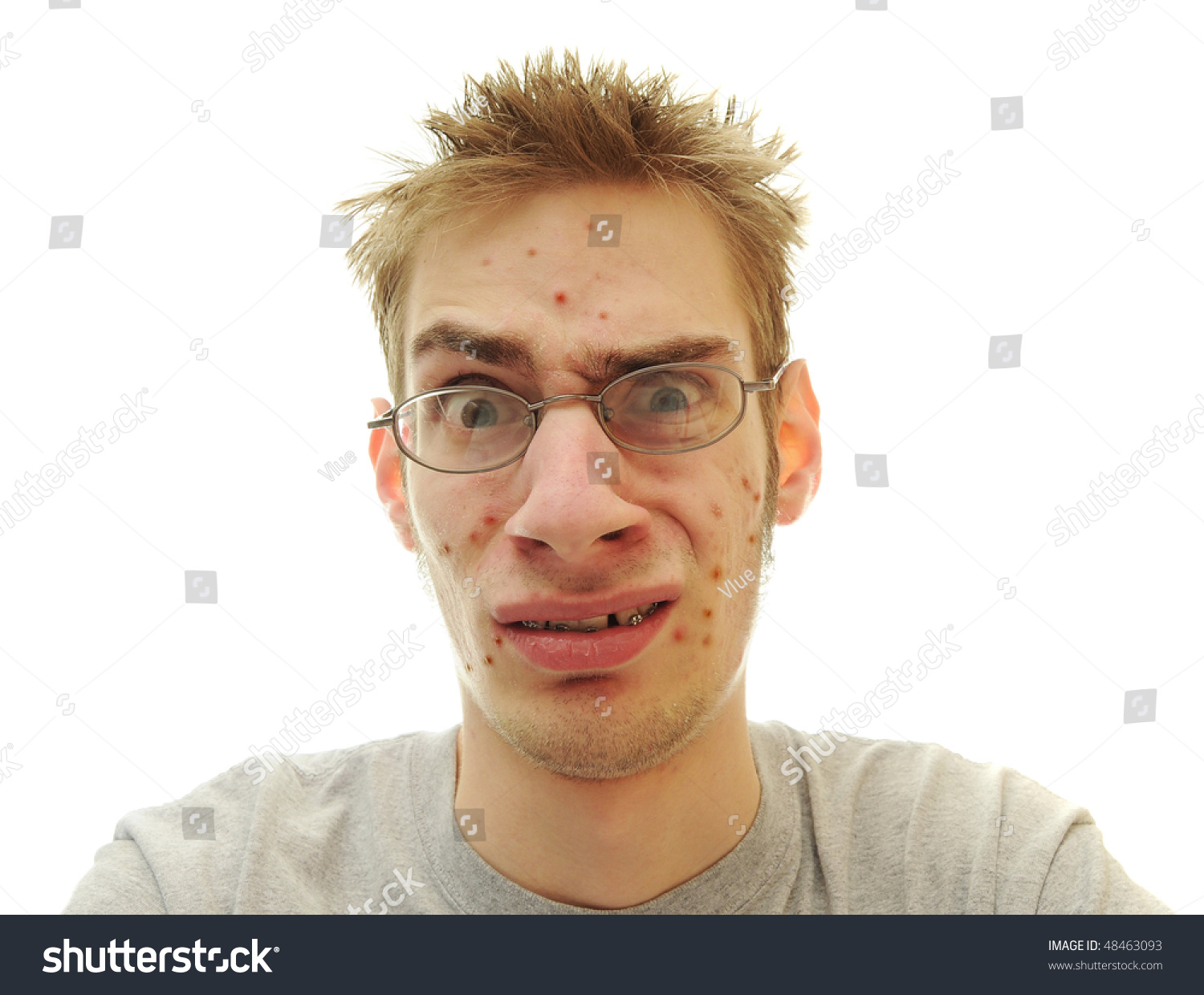 stock-photo-teenage-looks-embarrassed-and-confused-about-the-pimples-that-are-showing-up-all-over-his-face-48463093.jpg