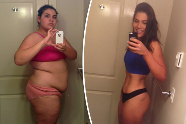 Laura-Micetich-before-and-after-weight-loss-520154.jpg