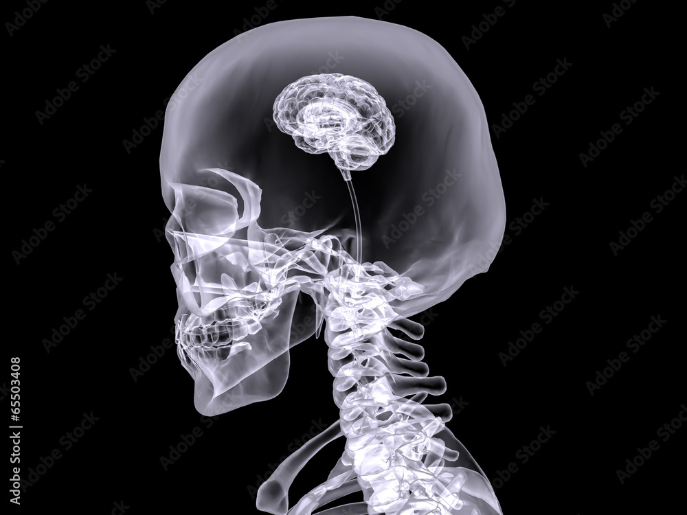 X-ray small brain #2 Stock Illustration | Adobe Stock