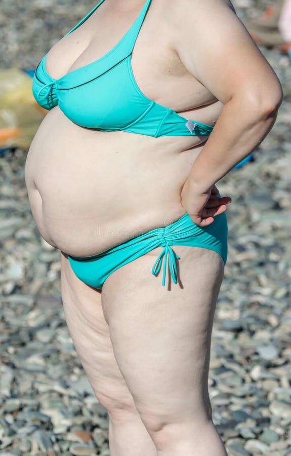 fat-woman-swimsuit-sea-beach-140883418.jpg