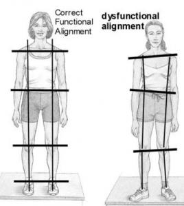 link_between_posture_and_health_1.jpeg