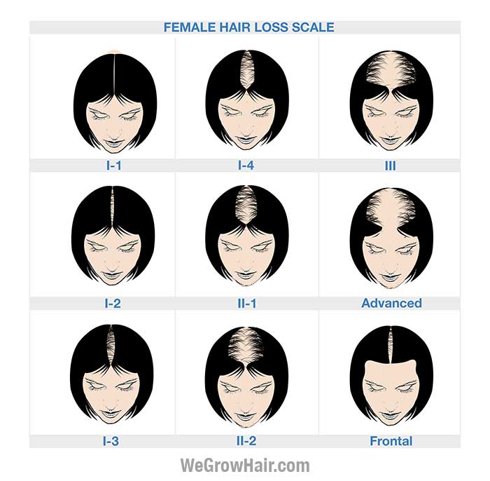 ludwig-scale.jpg