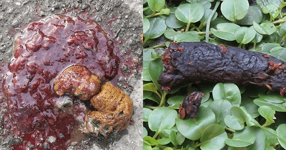 blood-in-stool-min-min.jpg