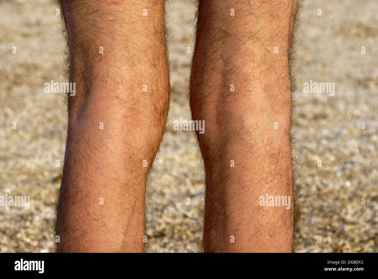 male-hairy-legs-DGBEK2.jpg