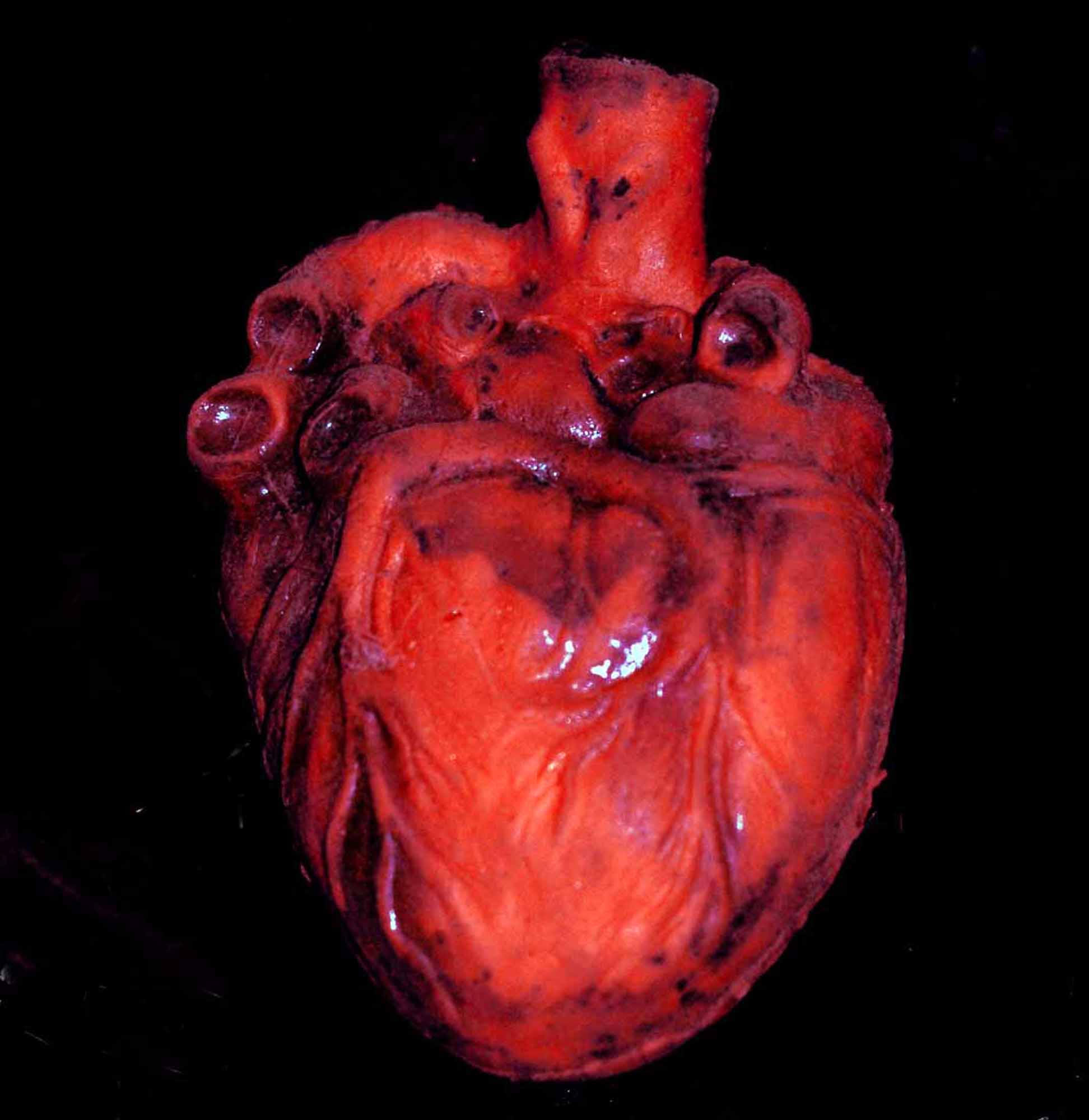 it_takes_real_heart__by_spyderwebb666.jpg