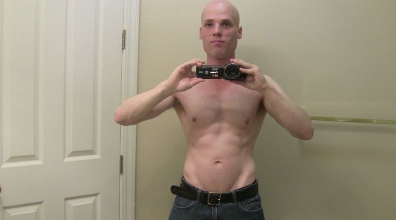 bald.jpg