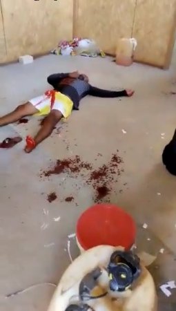 Dude Is Slowly Dying From Self-Inflicted Wounds