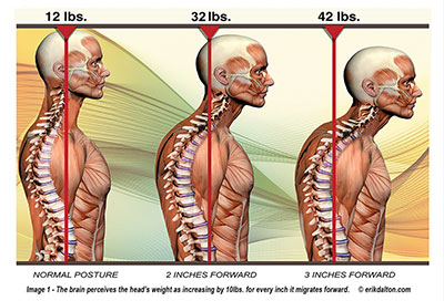 tech-neck-chiropractor-fonke-resized.jpg