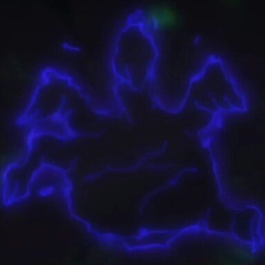 JfrOTe5.png