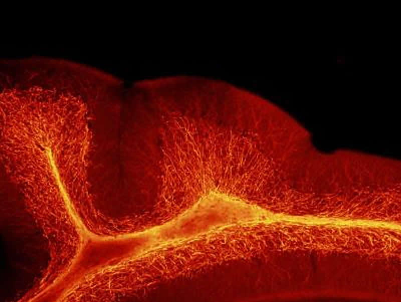 neurosciencenews.com