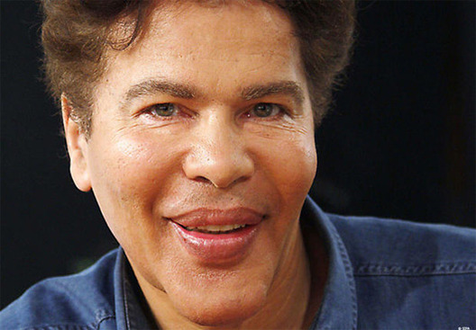 Ridiculous_Male_Plastic_Surgery_Fails_10.jpg