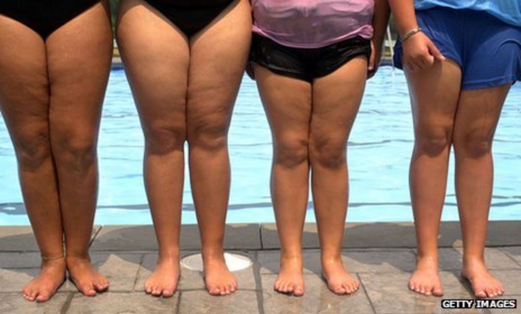 _63102695_fatgirlslegs_getty.jpg