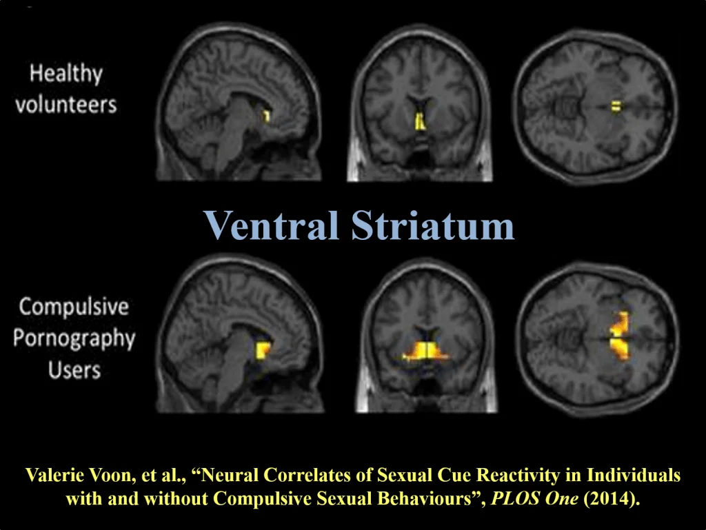 porn-on-the-brain-1024x769.png.webp