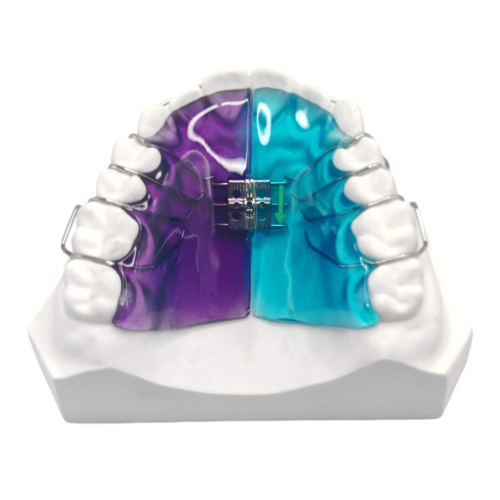 www.bracesshop.com